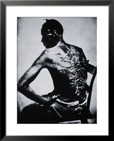 The Scarred Back of a Male Slave c1855 Framed Print