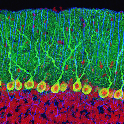 Triple Fluorescent Labeled Section, Purkinje Neurons are Labeled Green, the Glia are Labeled Blue Stretched Canvas Print