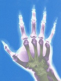X-ray of a Hand