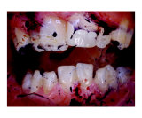 Natures Teeth