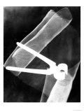 Photogram with Pliers  1920