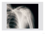 Shoulder