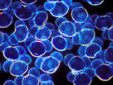 Pine Tree Pollen