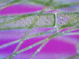 Eucaryotica Algae  Rhizoclonium Species  Chloroplasts Visible