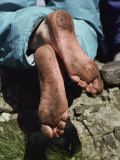 Close up of a Pilgrims Feet after Walking the Stations of the Cross on Lough Derg