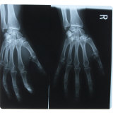 Close-up of X-Ray Photograph of Hands