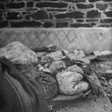 Wounded German Soldier After Being Taken Prisoner During Battle of the Bulge of WWII