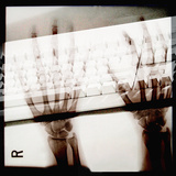 X-Ray Photograph of Person's Hands on Keyboard