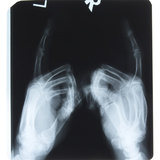 Close-up of X-Ray Photograph of Hands