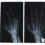 X-Ray Photograph of Person's Hands