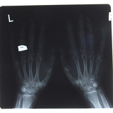 Close-up of X-Ray Photograph of Hands