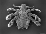 Scanning Electron Microscopic View of a Crab Louse