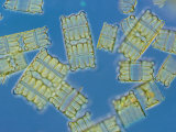 Magnified View of Diatoms That Reproduce by Simple Cell Division