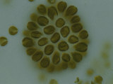 A Close View of a Colonial Freshwater Phytoplankton