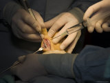 A Surgeon Grinds Down a Bone While It is Being Sprayed to Keep It Cool