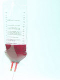 hazards of blood transfusion picture