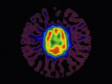 Nuclear Medicine-Gamma