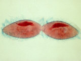 Paramecium Caudatum Undergoing Fission