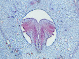 Magnolia Species  Flower Head Detail Showing Developing Ovules