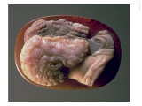 Cameo Depicting Marcus Aurelius