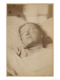 Hysterical Epilepsy  Paris  c1876