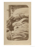 Attack of Hysteria  Iconographie Photographique by Bourneville and Regnard  Plate II  Paris  1876