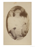 Hysterical Epilepsy  Plate XVII  Paris  c1876
