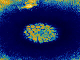 Human Papilloma Virus Color Tem
