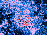 Electron Micrograph West Nile Virus Colorized