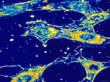 Normal Human Connective Tissue  X500 at 35 Mm Size