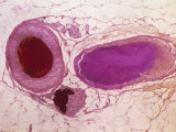 Artery  Vein  Capillary Artery  Vein  Capillary