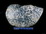 Lung Minimal Centrilobular Emphysema
