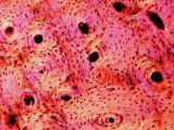 X10 Bone Ground Haversian Canal Skeletal Lamellae