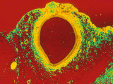 Normal Artery  Cross Sectn Photomic-Color