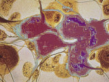 Digitized Nerve Cells Impulse Lost
