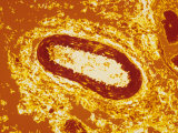 Colorized Cross Section Artery in Tissue Section