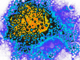 Hepatitis B Virus