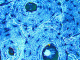 Compact Bone X400 Mag Haversian Canal Osteocytes