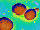 Gram Bacteria Streptococcus Pneumoniae
