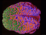 Human Brain Colorized