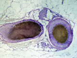 Normal Artery Vein and Capillary Micrograph X100