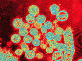Tem: Sin Nombre or Hanta Virus-- an Rna Virus