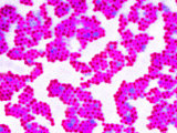 MRSA Infections Occur Most Frequently in Hospitals and Healthcare