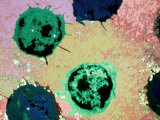 White Blood Cells Tem X5000 at Negative