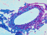Tissue Section Artery False Colored Micrograph