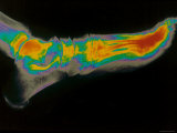 Normal Foot X-Ray