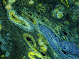 Photomicrograph Ovary Human X10
