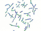 Human Chromosomes Changed to Z087-N-761