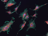 Mammalian Nerve Cells Dendrite Sensory Synapse