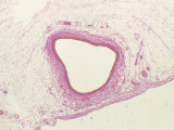 Normal Artery  XS Photomicrograph